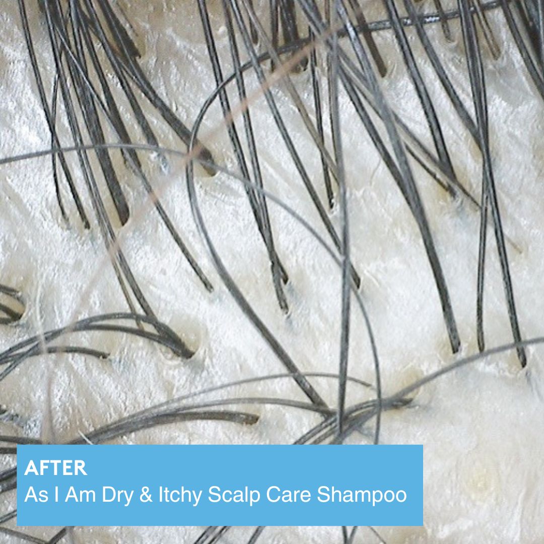 Dry & Itchy Scalp Care Shampoo